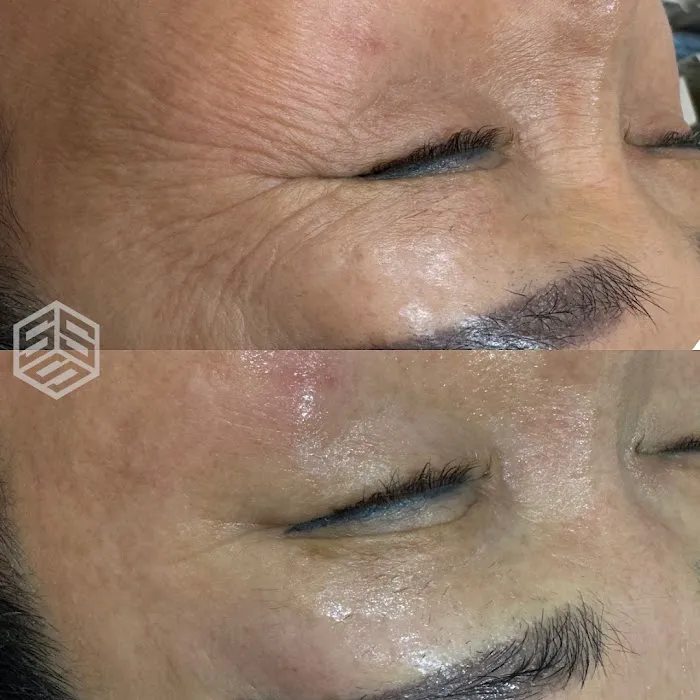 SKIN BY SIO Picture 1