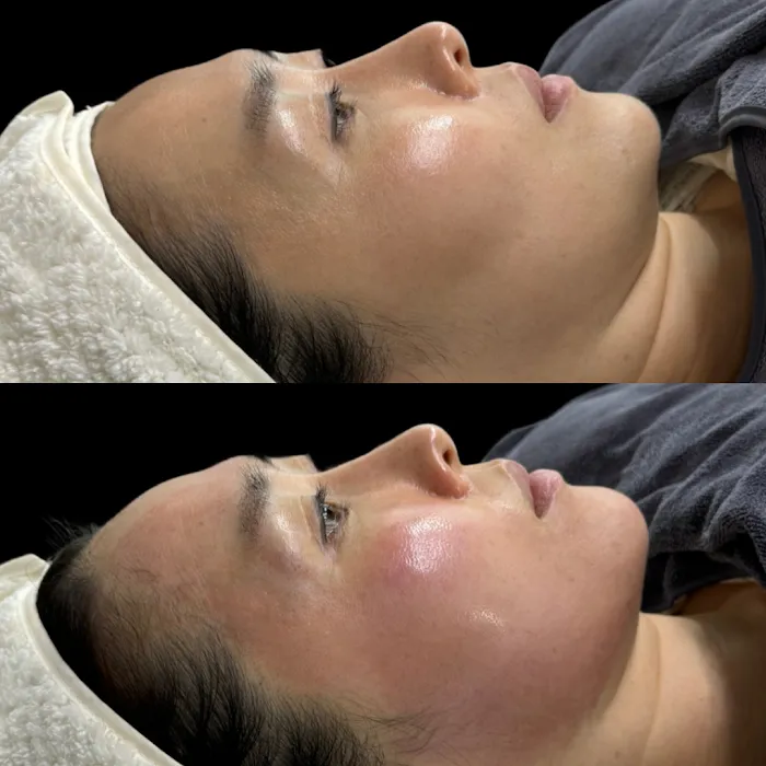 SKIN BY SIO Picture 3