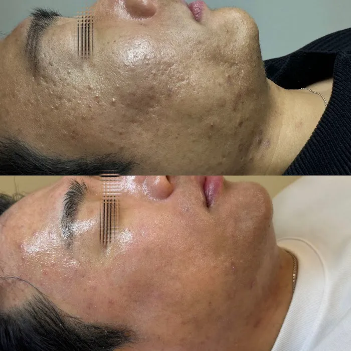 SKIN BY SIO Picture 5