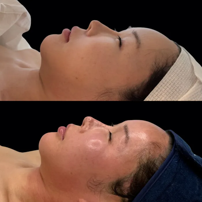 SKIN BY SIO Picture 7