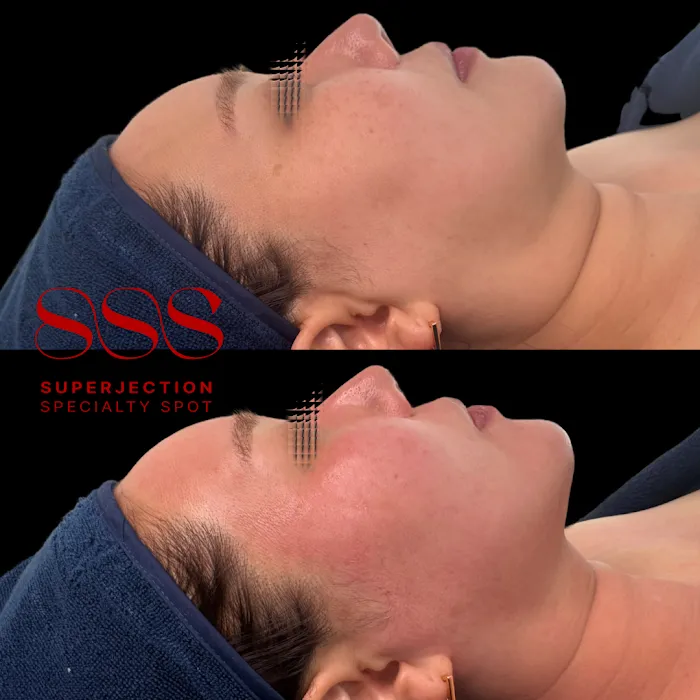 SKIN BY SIO Picture 6