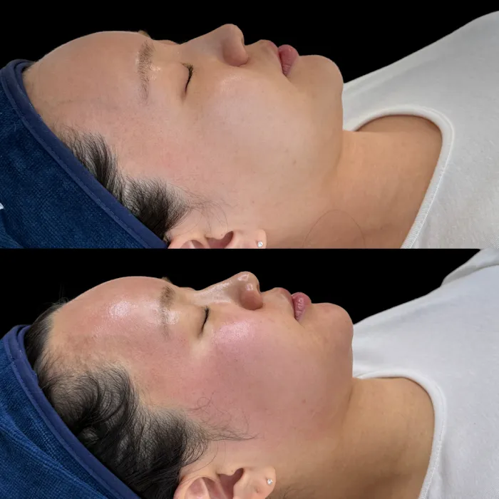 SKIN BY SIO Picture 8