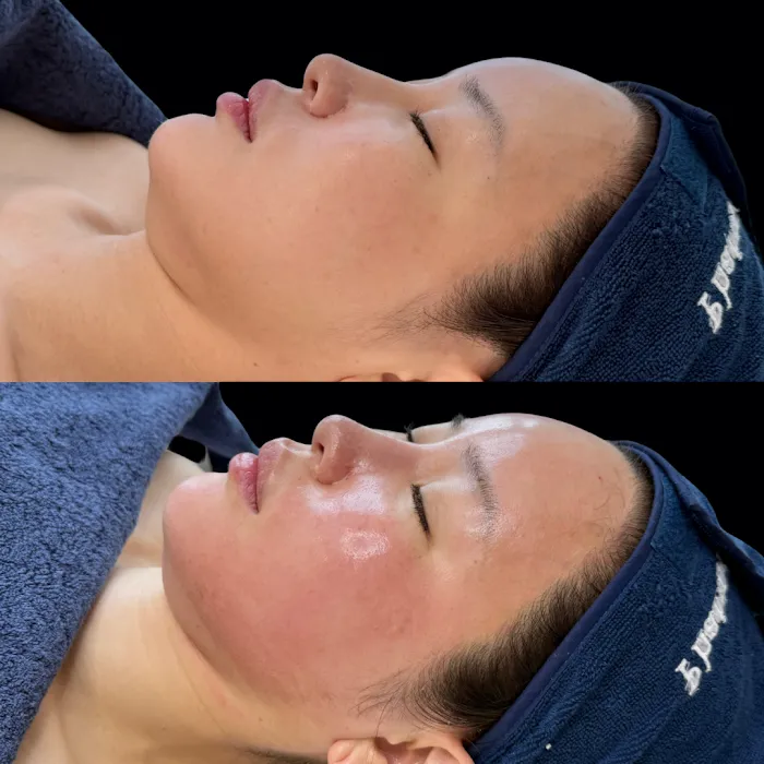 SKIN BY SIO Picture 9