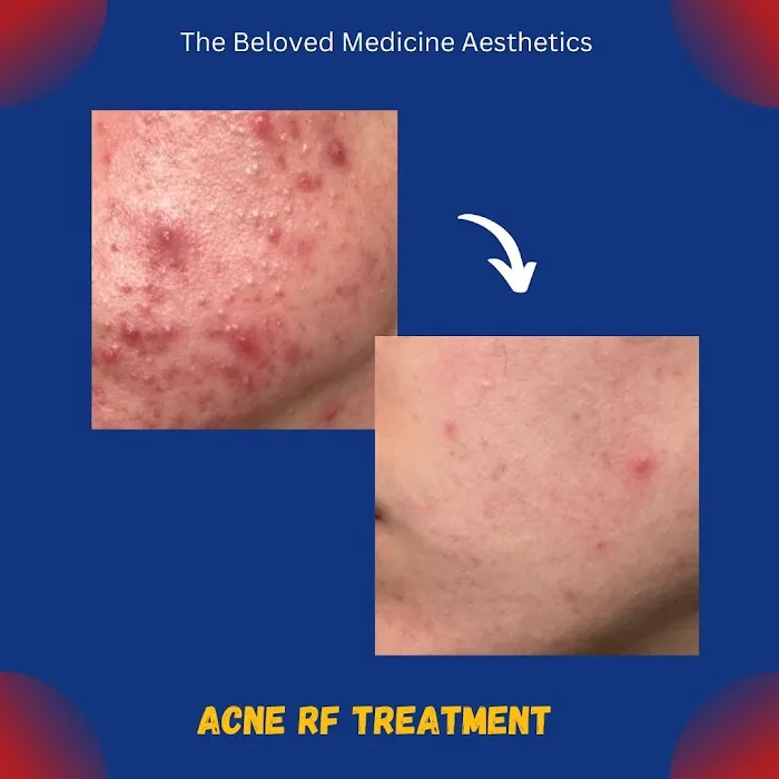 The Beloved Medicine Aesthetics Picture 7