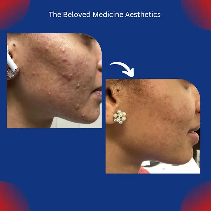 The Beloved Medicine Aesthetics Picture 4
