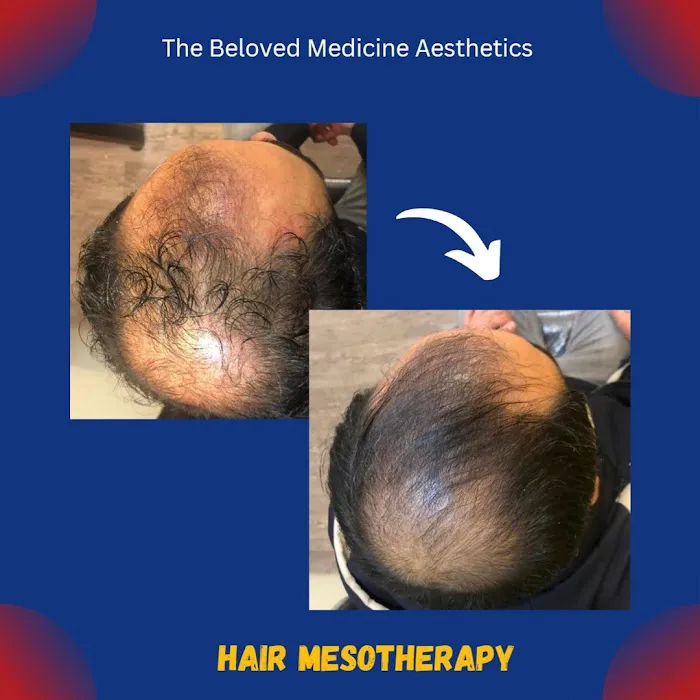 The Beloved Medicine Aesthetics Picture 6