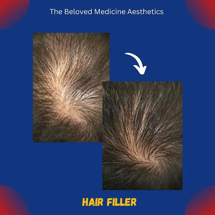 The Beloved Medicine Aesthetics Picture 5