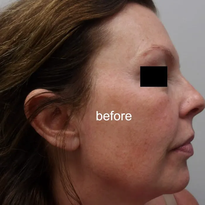 The Beloved Medicine Aesthetics Picture 9