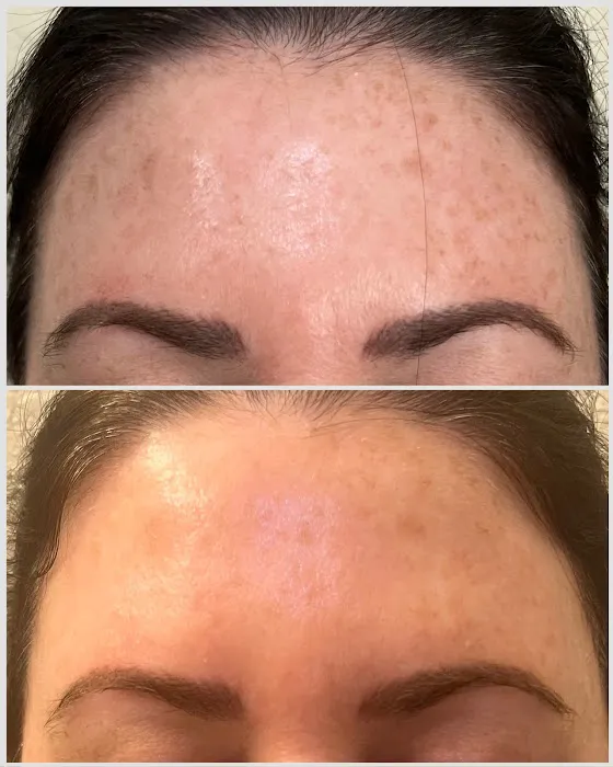 Modern Skin Pro Picture 1