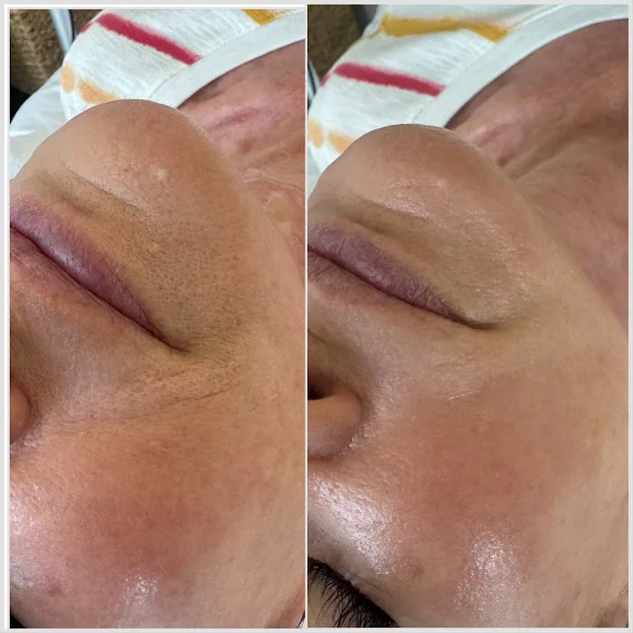 Modern Skin Pro Picture 2