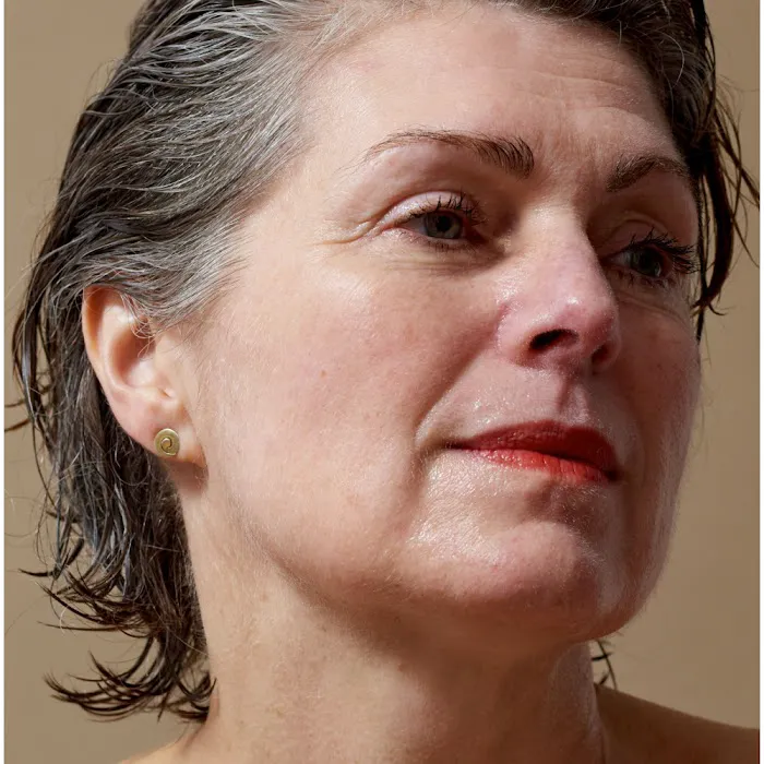 Skin Laundry - The Hill Picture 6