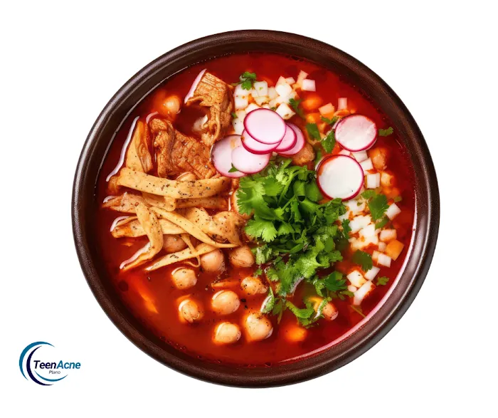 Teen Acne Plano Picture 9