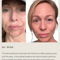 MV Skin Consulting ico