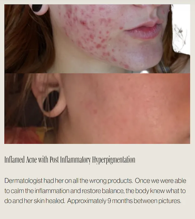 MV Skin Consulting Picture 2