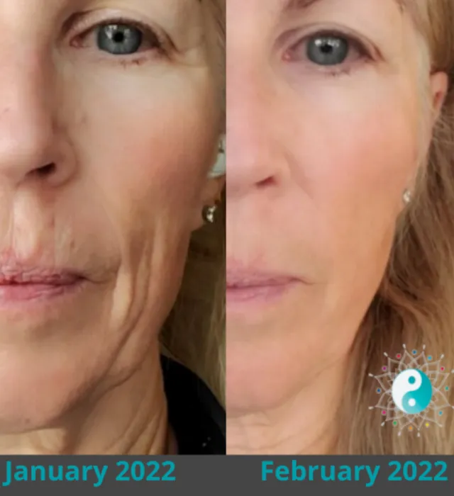 MV Skin Consulting Picture 3