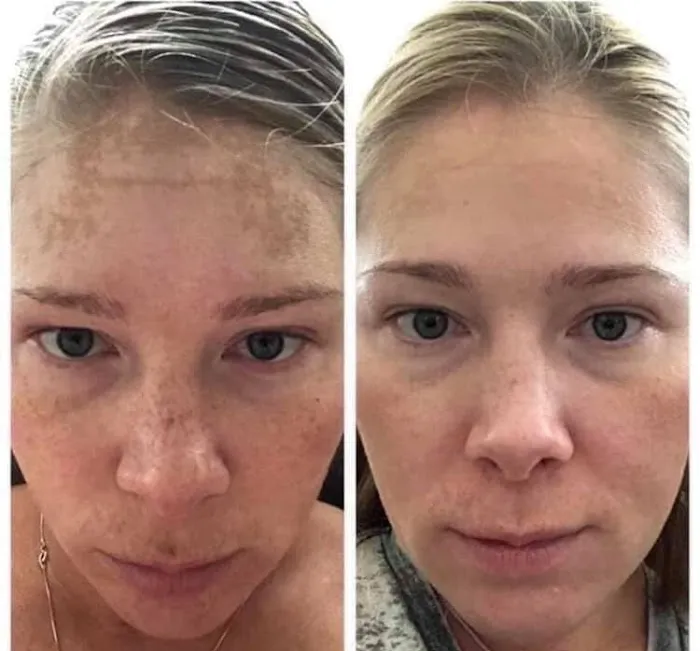 Lisa Clark - Neora Picture 2