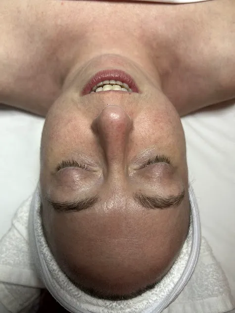 The Fixx Skincare Picture 7