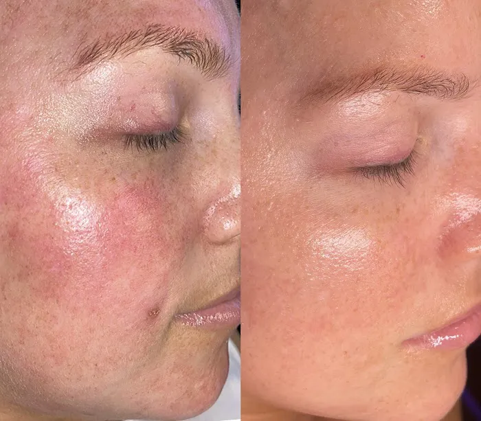 Velvet Bloom Skin Studio Picture 8