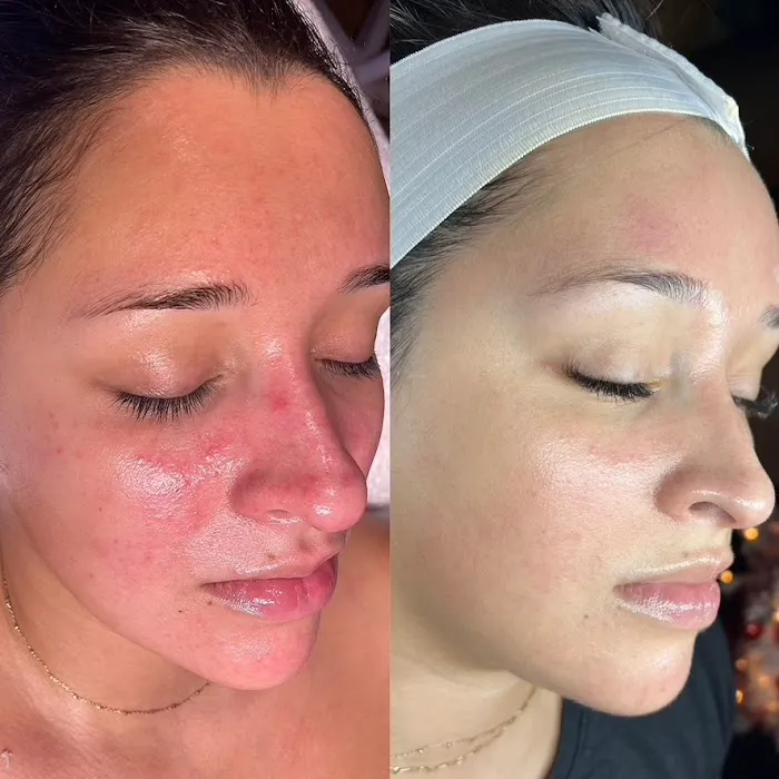 Velvet Bloom Skin Studio Picture 6