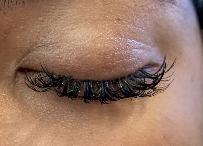 Avanti Skin Center of Willow Bend Picture 1