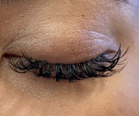 Avanti Skin Center of Willow Bend