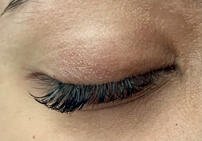 Avanti Skin Center of Willow Bend Picture 7