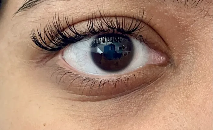 Avanti Skin Center of Willow Bend Picture 8