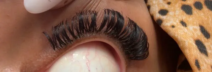 Avanti Skin Center of Willow Bend Picture 9