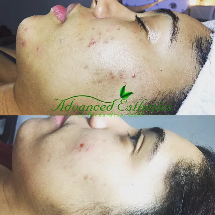 Advanced Esthetics of Richardson, LLC Picture 6