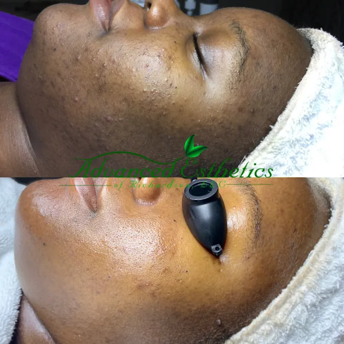 Advanced Esthetics of Richardson, LLC Picture 9