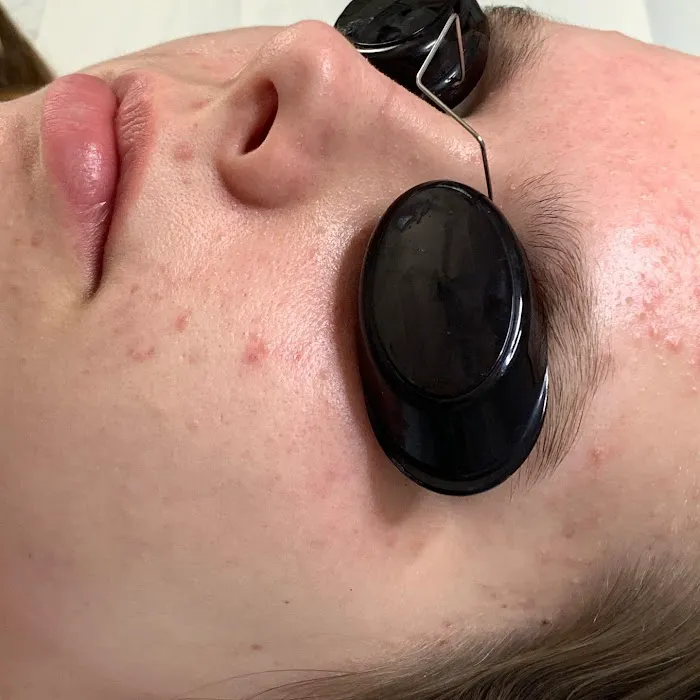 Clear Beauty Acne Clinic Picture 8