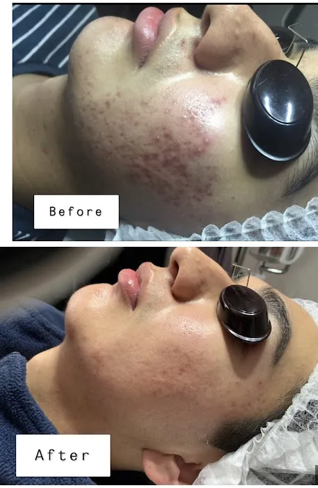 Clear Beauty Acne Clinic Picture 10