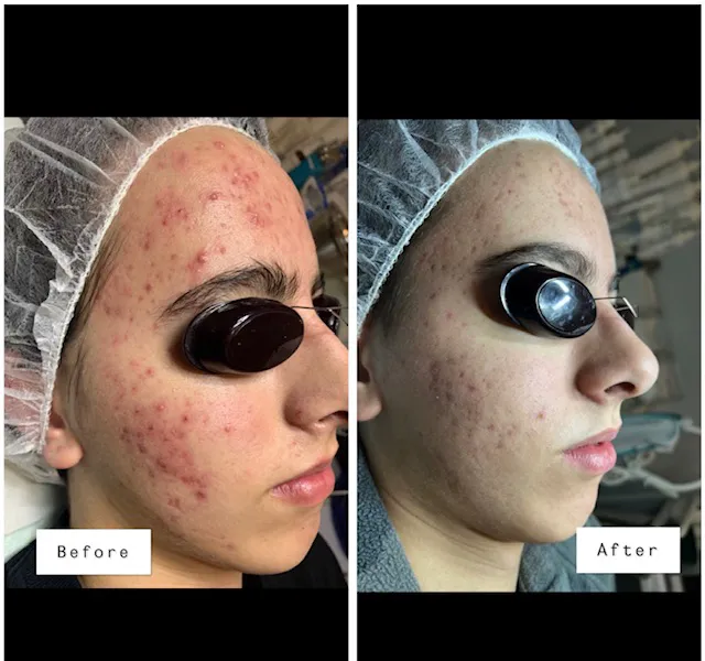 Clear Beauty Acne Clinic Picture 9