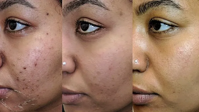 Skin Slayer Picture 3