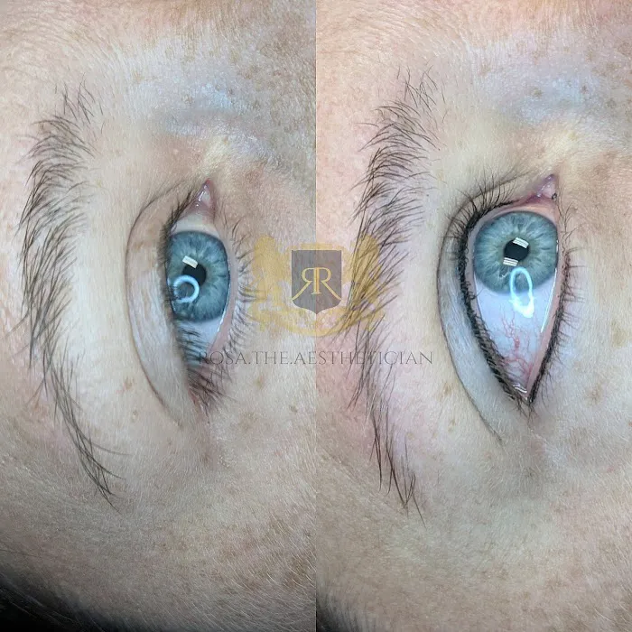 Skin Slayer Picture 5