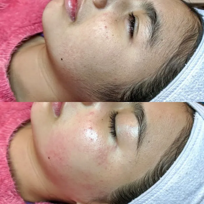 Skin Slayer Picture 7