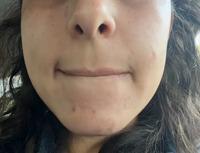 Skin Slayer Picture 8