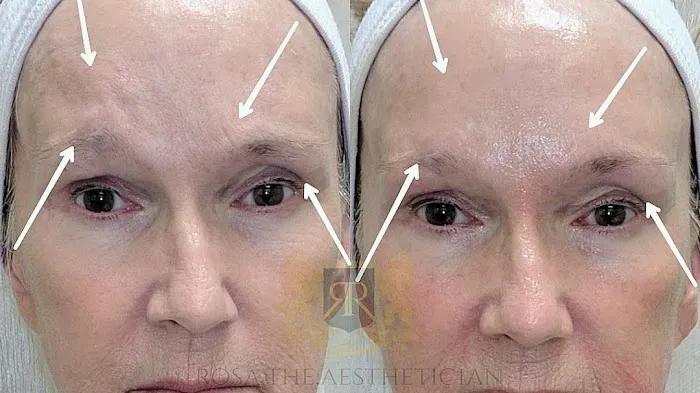 Skin Slayer Picture 9