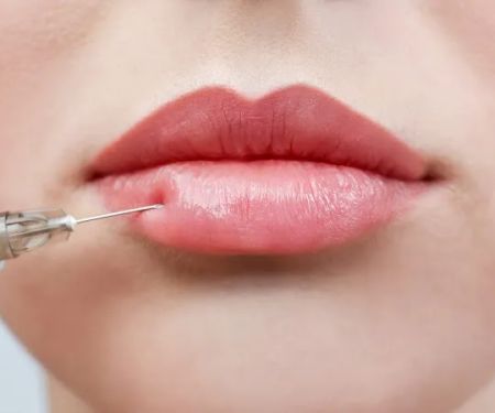 Regional Skin & Laser Center