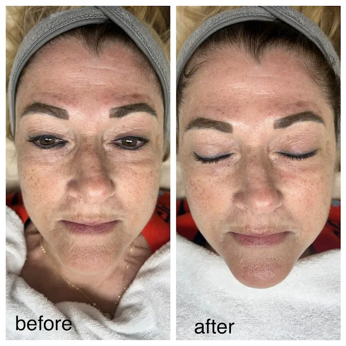 Aden Skincare Picture 7