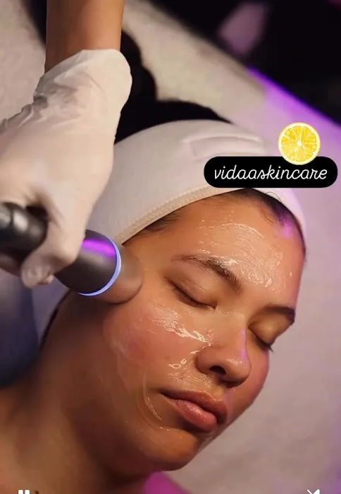 vidaaskincare Picture 4