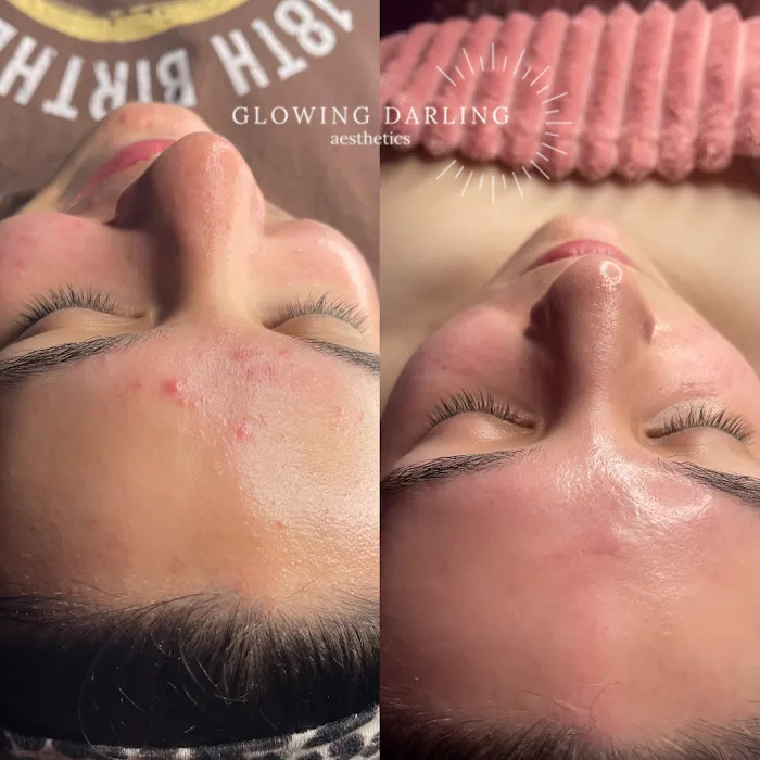 Glowing Darling Esthetics Picture 3