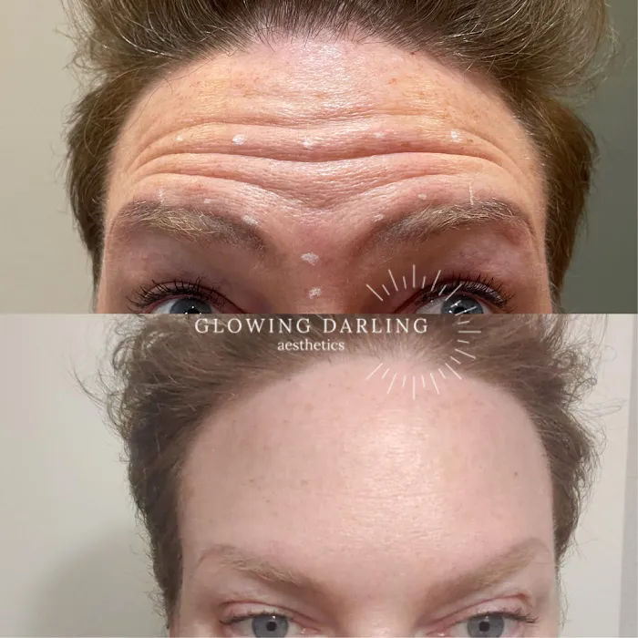 Glowing Darling Esthetics Picture 8