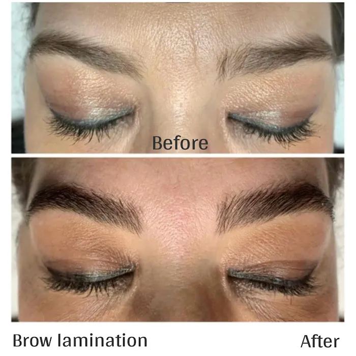 effective skin solutions Picture 2