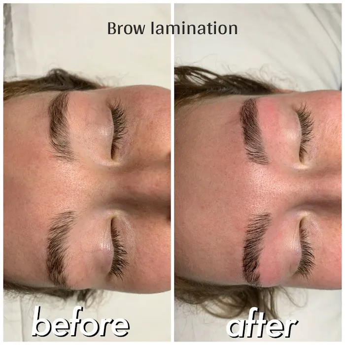 effective skin solutions Picture 4