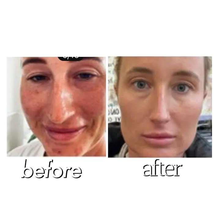 effective skin solutions Picture 7