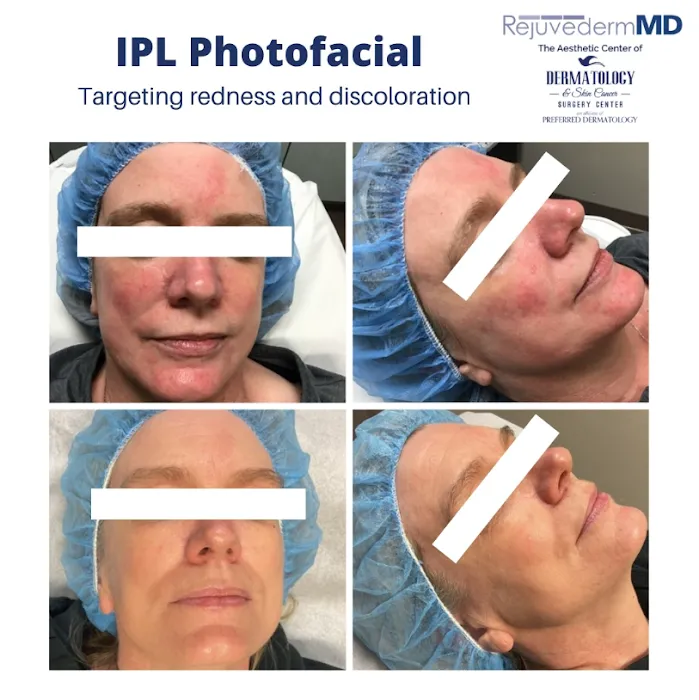 RejuvedermMD Aesthetic Center Picture 8