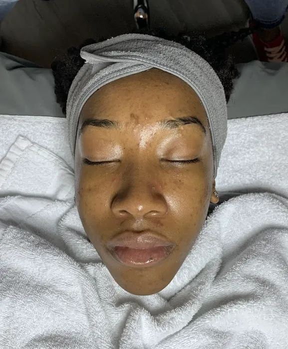 You Glow Skin Care Picture 5