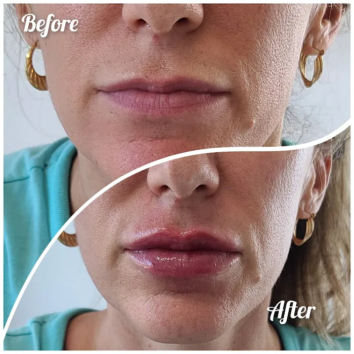 Vybe Aesthetics Picture 2