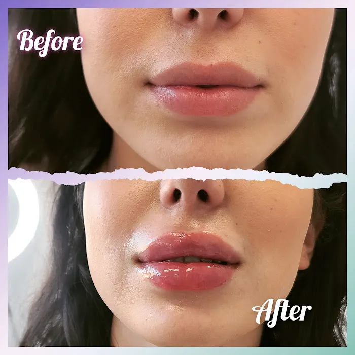 Vybe Aesthetics Picture 4